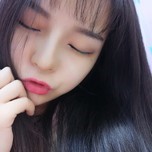 แนน-ศัลยกรรมจมูกเกาหลี-2เดือน