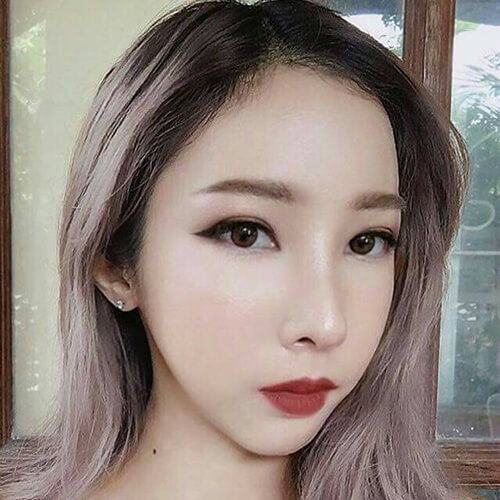 ภาพพิมพ์-หลังศัลยกรรม-1ปี