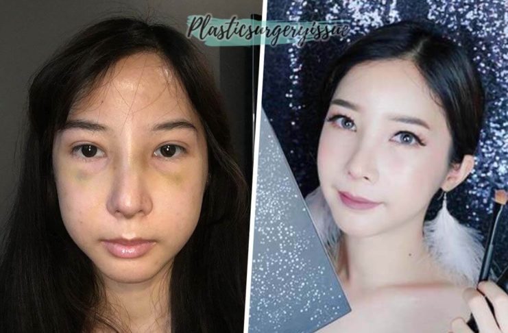 ศัลยกรรมรีวิว-ภาพพิมพ์-Beauty-Blogger-ปัจจุบัน