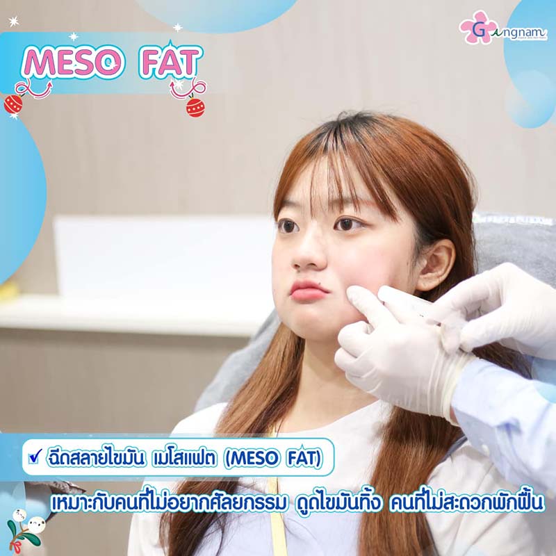 ฉีดเมโสแฟต meso fat เหมาะกับใคร