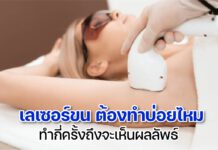 เลเซอร์ขน ทำกี่ครั้ง ทำบ่อยไหม
